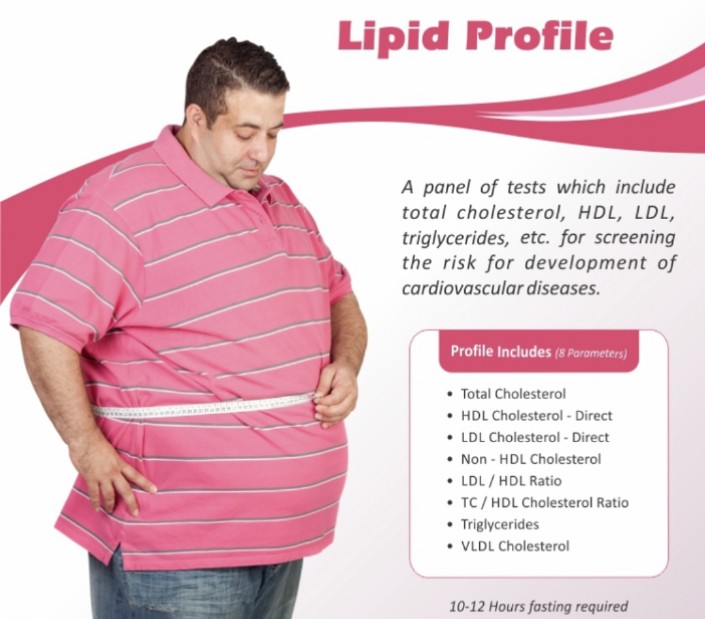 Lipid Profile Test